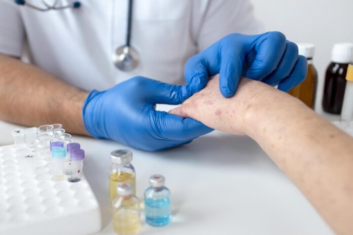 masalas Latvijā, Baiba Rozentāle, masalu uzliesmojums, nevakcinēti bērni, SPKC, masalu simptomi, infekcijas slimības, vakcinācija Latvijā, sabiedrības veselība, epidemioloģiskā situācija